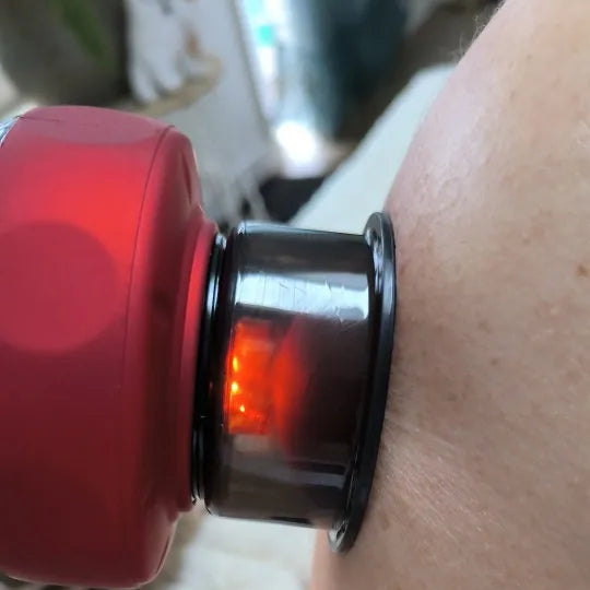 VacuThera™ Pro – Electric Cupping